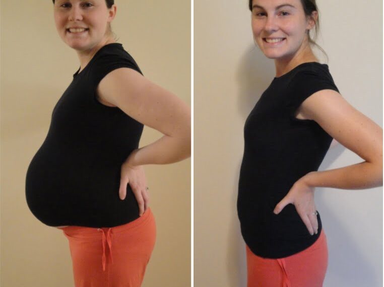 Garbhawastha Ke Baad Pet Kam Karne Ka Tarika Upay Reduce Weight after Pregnancy Hindi